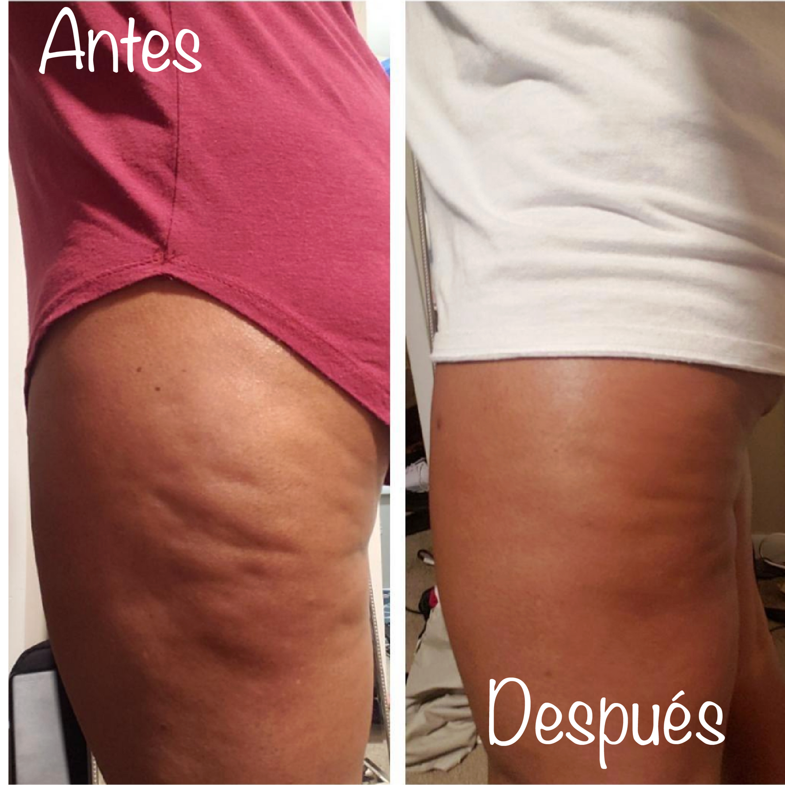 Resultados Visibles con