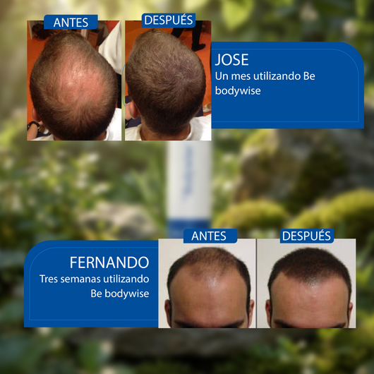 Nuvora Roll On - Suero de romero para el crecimiento del cabello